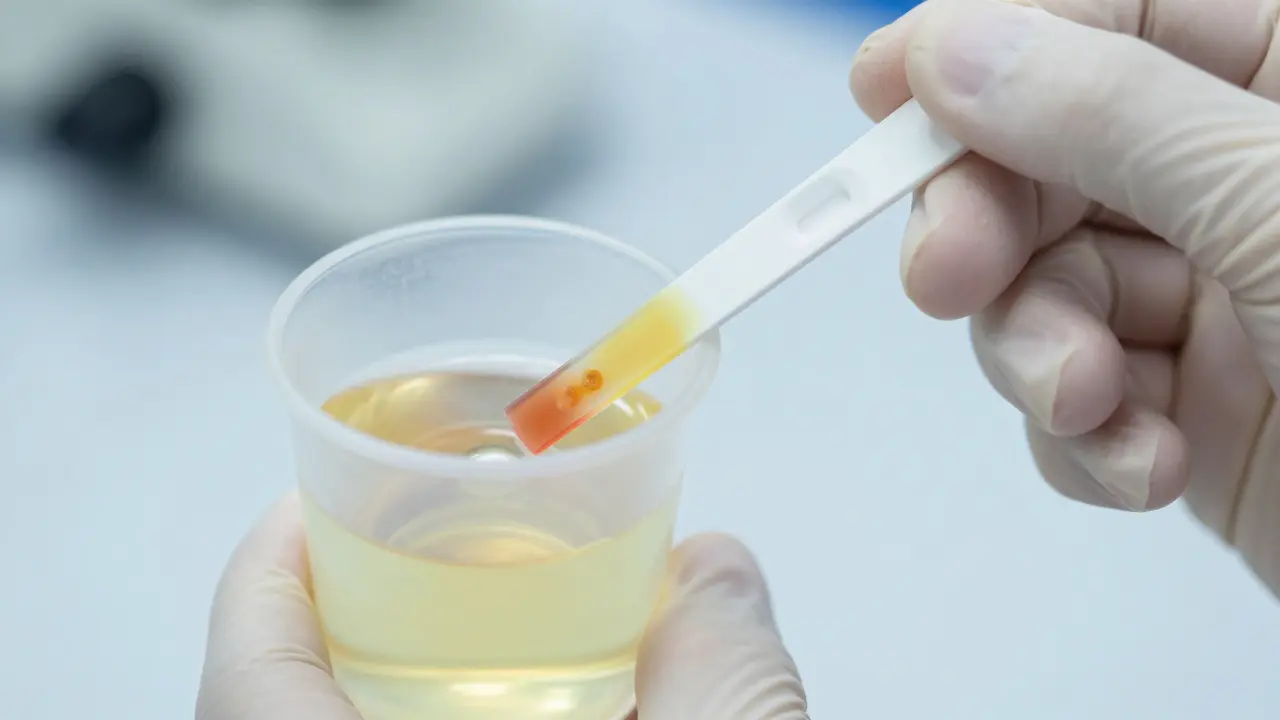 Urine dipstick test showing color changes for albumin detection.